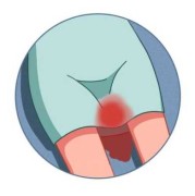 宫腔内出血什么原因,孕期宫内出血的原因有哪些