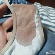 孕期有少量出血（怀孕14周，一切正常，突然流血，怎么回事）