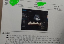 医生说胎儿腿长（医生说胎儿腿长是暗示男女吗）