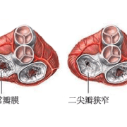 胎儿心脏结构异常（胎儿心脏结构异常什么原因导致的）