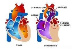 胎儿左心发育不良（胎儿左心发育不良还能要吗）