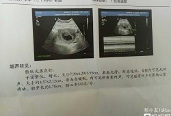 一般怀孕多少天可以看见孕囊呀，通过孕囊大小可以判断出男女吗,胎囊就是胎儿吗?
