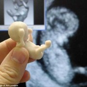 孕16周胎儿稳定了吗,怀孕四个月胎儿稳定了吗?