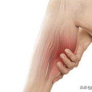产妇腿酸痛怎么办,孕期肌肉酸痛什么原因