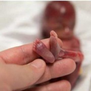 19周孩子可不可以打掉,怀孕19周胎儿稳定了吗正常吗