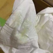 孕期白带脓球（脓性白带是怎样的）