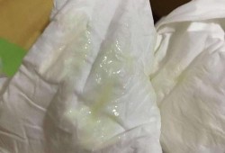 孕期白带脓球（脓性白带是怎样的）