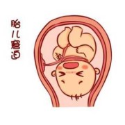 胎儿不稳（胎儿不稳定是什么原因）