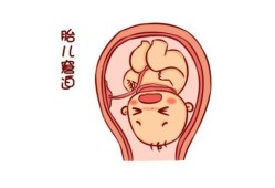 胎儿不稳（胎儿不稳定是什么原因）