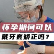 怀孕期间可以戴牙套吗（怀孕期间可以戴牙套吗）