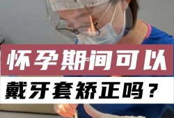 怀孕期间可以戴牙套吗（怀孕期间可以戴牙套吗）