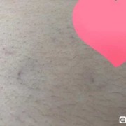 孕期长毛（孕妇肚子上长毛怎么回事）