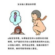 急性胎儿窘迫（急性胎儿窘迫）