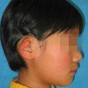 怀孕期间胎儿一般几个月就会成形了呢,胎儿耳朵什么时候成型的