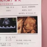 四维彩超对胎儿的影响（四维不过关是什么原因啊？刚做的检查了，这样胎儿会发育不好吗）