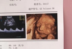四维彩超对胎儿的影响（四维不过关是什么原因啊？刚做的检查了，这样胎儿会发育不好吗）