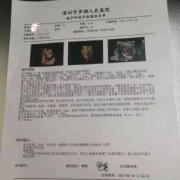 怀孕天数怎么算的？B超可以检测出，怀孕的天数吗,胎儿周期计算表