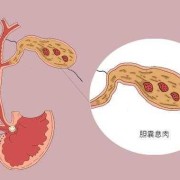 胎儿胆囊小怎么补救（胎儿胆囊小怎么补救好）