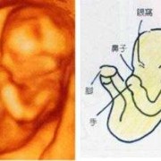 左枕后位真人胎儿图（左枕后位胎儿是男是女）