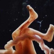 孕17周肚子发紧发硬会影响胎儿吗,怀孕17周胎儿图片大全