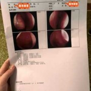 孕妇鼻屎多怎么回事,孕期鼻屎多怎么回事,而且还有血丝