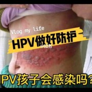 感染hpv病毒的患者生小孩会传染给小孩吗,母亲hpv感染对胎儿的影响