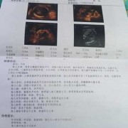 脑中线居中是什么意思啊,胎儿脑中线居中是什么意思