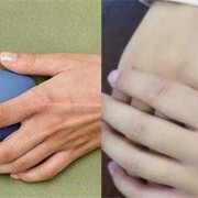 孕期右手发麻（孕期右手发麻是什么原因）