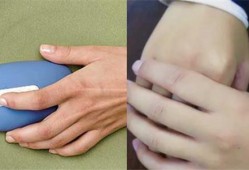 孕期右手发麻（孕期右手发麻是什么原因）