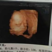 宝宝总皱眉怎么回事,胎儿皱眉头的四维