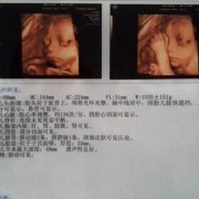 孕27周胎儿在什么位置?怎么知道,怀孕27周胎儿彩超图片