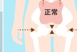 孕妇耻骨疼怎么回事,孕期趾骨痛在哪个部位