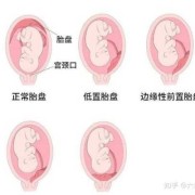 孕妇血压低对胎儿发育有影响吗,胎盘低会影响胎儿发育吗知乎
