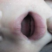 五个月的胎儿图片（婴儿5个月长牙正常吗?刚开始长的是上边的牙齿还是下边的呢）