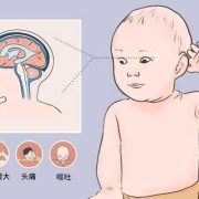胎儿脑积水会怎么样（胎儿脑积水怎么样会自己吸收吗）