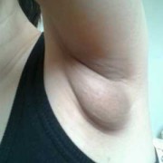 孕期腋下有味道（怀孕以后腋窝长了一个肉疙瘩是怎么回事）