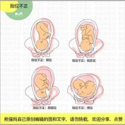 入盆后胎儿的姿势（入盆后胎儿的姿势有哪些）