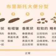 大便拉不出来是什么原因,孕期大便不通畅怎么办