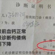 胎儿佝偻病（胎儿佝偻病b超能看出来吗）