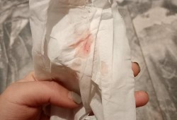 怀孕期间有点出血（怀孕期间有点出血正常吗）
