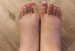 怀孕期间腿肿怎么回事（怀孕几个月开始腿脚肿）