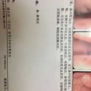 喉咙吐口水带血怎么回事,孕期吐出血是怎么回事儿