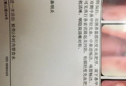 喉咙吐口水带血怎么回事,孕期吐出血是怎么回事儿