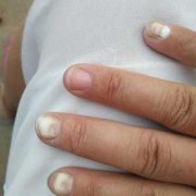 孕期变白（孕期变白了生出来的小孩会很白吗）