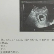 胎儿头小一定是女孩吗（孕妇怀孕31周B超检查胎儿头相当于34-35周的怎么办）