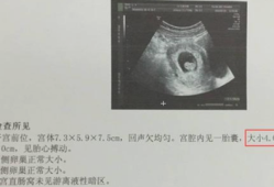 胎儿头小一定是女孩吗（孕妇怀孕31周B超检查胎儿头相当于34-35周的怎么办）