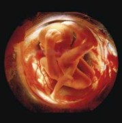 36周胎儿六斤算大吗,怀孕6周胎儿多大图片