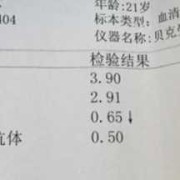 孕期甲状腺素偏低（孕期甲状腺素偏低是什么原因造成的）