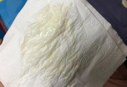 孕期白带发黄怎么办,