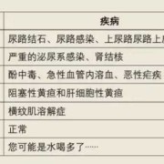 孕期尿很骚（尿的尿骚味特别大是什么原因）